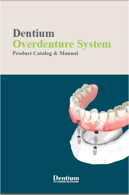 Overdenture System